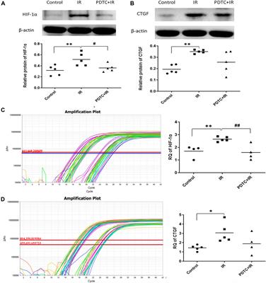 Pyrrolidine Dithiocarbamate Might Mitigate Radiation-Induced Heart Damage at an Early Stage in Rats